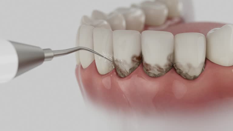 Reliable Dental Implants contractor in Hemet, CA by Smile Center Dentistry